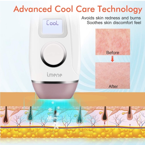 IMENE Permanent Hair Removal Machine - Picture 5 of 10